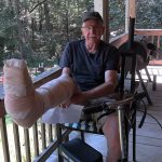 I Broke my Leg!