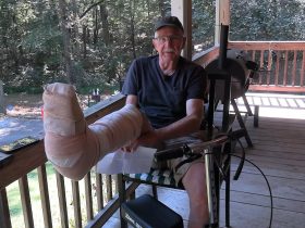 I Broke my Leg!